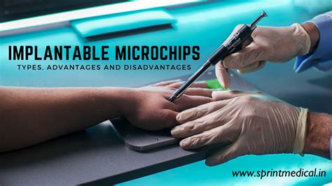 rfid chip implant in humans|Microchip implant (human) .